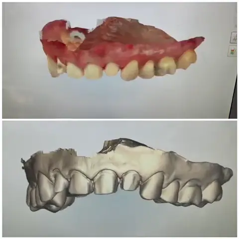 Escaneo Intraoral 3D en Vivo